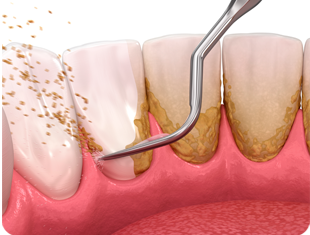 Periodontia